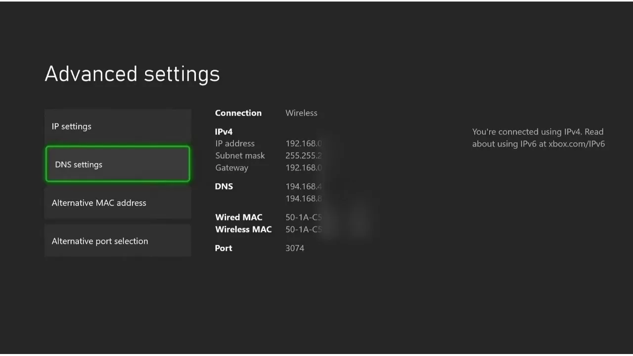 Configure Your Xbox DNS Settings